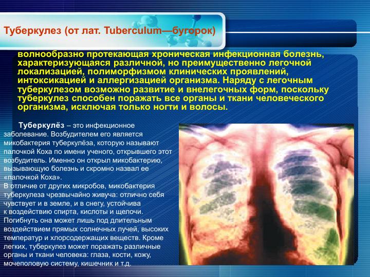 Лекция туберкулез_3